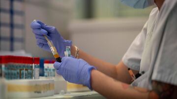 A scientist works at the serology laboratory of the San Carlos Clinic Hospital in Madrid on June 16, 2020. - Spain has suffered one of the world&#039;s most deadly outbreaks of the novel coronavirus that has claimed more than 27,000 lives, although author