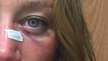 Mireia Belmonte pudo recibir un golpe antideportivo de Villa¨¦cija