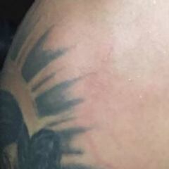 ¿La prueba de que no era penal? Así se ve el hombro de Samudio