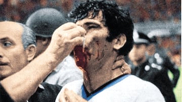 Néstor Combín acabó con el pómulo roto por un codazo de Aguirre Suárez.