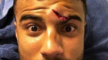 Rafinha shows off the injury he suffered from Ter Stegen's boot in the match against Athletic