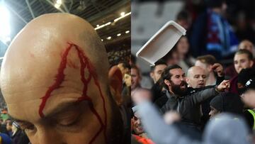 Lamentable: un monedazo dejó así la cabeza de un fan 'blue'