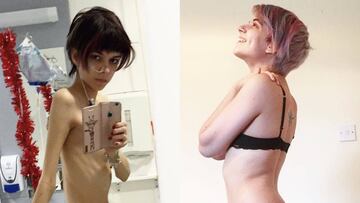 Una joven muestra cómo le ha ganado la batalla a la anorexia. Foto: Instagram