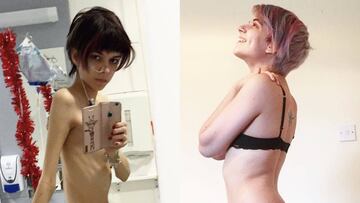 Una joven muestra c&oacute;mo le ha ganado la batalla a la anorexia. Foto: Instagram