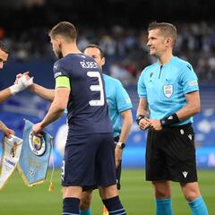 Why does Real Madrid’s Benzema always wear a bandage on his hand?