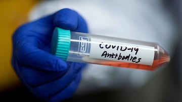 FILE PHOTO: Scientist Linqi Zhang shows a tube with a solution containing COVID-19 antibodies in his lab where he works on research into novel coronavirus disease (COVID-19) antibodies for possible use in a drug at Tsinghua University&#039;s Research Cent