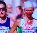 Imagen de la maratón: cubierta de sangre... y se lleva el oro