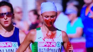 Imagen de la maratón: cubierta de sangre... y se lleva el oro