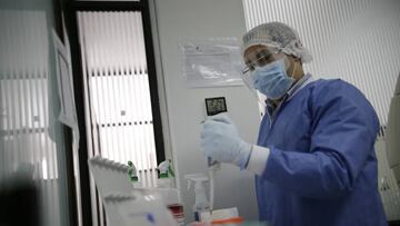 El Instituto Nacional de Salud explicó ante la Comisión Séptima del Senado las razones por las cuales se han disminuido las pruebas de Coronavirus en el país