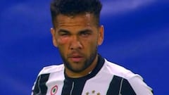 En Italia comparan a Alves con Rocky tras su golpe en el ojo