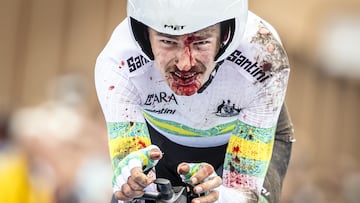 Zurich (Switzerland), 22/09/2024.- Jay Vine of Australia crosses the finish line with bloo don his face during the Men's Elite Individual Time Trial race at the 2024 UCI Road and Para-cycling Road World Championships in Zurich, Switzerland, 22 September 2024. (Ciclismo, Suiza) EFE/EPA/MICHAEL BUHOLZER