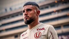 Muestran cómo quedó la mano de Rodrigo Ureña tras recibir un pisotón: impactante