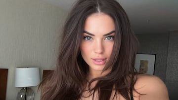 Los excesos de Alyson Eckmann: de sus múltiples retoques estéticos a las drogas