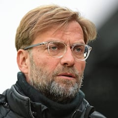 Klopp confía en sus opciones: "Si atacamos al City y defendemos muy arriba, tendrán dificultades"