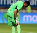 Keylor Navas está lesionado y podría no jugar la Copa Oro