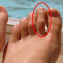 ¿Tienes este dedo del pie más largo? ¡Pues ten cuidado!