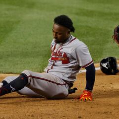 Braves Ozzie Albies out for at least two months with fracture