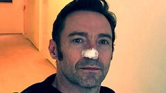 Hugh Jackman anuncia que ha vuelto a ser operado por su c&aacute;ncer