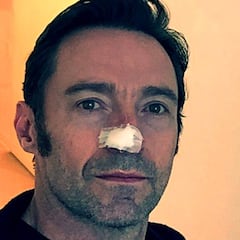 Hugh Jackman ha vuelto a ser intervenido de su cáncer