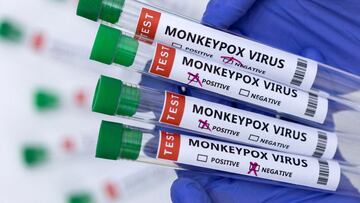 Test tubes labelled "Monkeypox virus positive and negative" are seen.