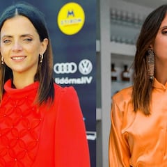 La verdadera razón detrás de la 'operación' de agrandamiento de nariz de Macarena Gómez