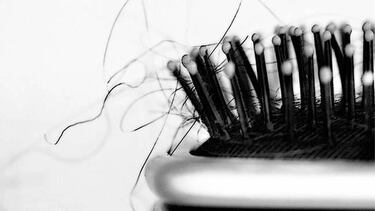 ?ltima moda contra la alopecia: injerto capilar en Turqua
