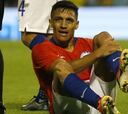 Alexis sufre una lesión en el tobillo y es liberado de la Roja