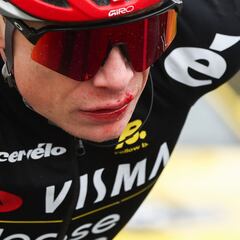 Vingegaard abandona en París-Niza tras su caída