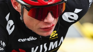 Team Visma-Lease a Bike's Danish rider Jonas Vingegaard reacts as he cycles after falling during the 5th stage of the Paris-Nice cycling race, 196,5 km between Saint-Just-en-Chevalet and La C�te-Saint-Andr�, on March 13, 2025. (Photo by Anne-Christine POUJOULAT / AFP)