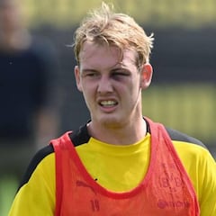 Julian Brandt aparece con un ojo morado en el entrenamiento