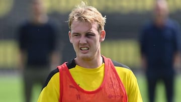 Julian Brandt aparece con un ojo morado en el entrenamiento