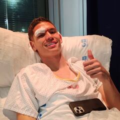 Nuevo contratiempo en el Mirandés: Luna, KO