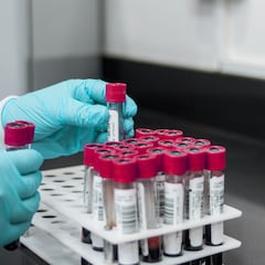 Hallan el primer anticuerpo que ataca las células madre del cáncer