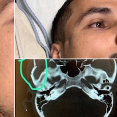 El codazo de Ibra que le ha dejado la cara así a un rival