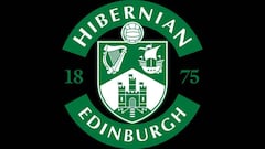 Manchester City loan out Ghana winger Agyepong to Scottish side Hibernian