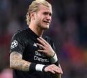Perdura el calvario de Karius