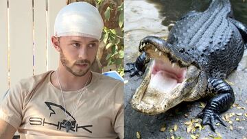 sobrevive ataque caiman mordisco cabeza