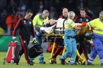 Las imágenes de la fractura de tibia de Luke Shaw