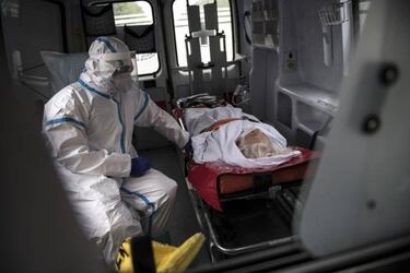 ¿El coronavirus cambia el color de la piel?