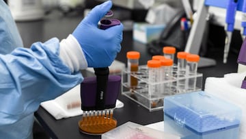 El CSIC advierte sobre la pomada con anticuerpos de la COVID-19: no existe evidencia de su eficacia