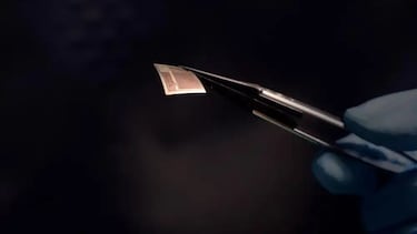 Adiós al Neuralink de Musk: el pequeño implante que promete conectar el cerebro con la inteligencia artificial