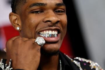 Detalle de la dentadura inferior de Scoot Henderson, con unos grillz policromados, que buscaba brillar por sí mismo en la noche del draft. 