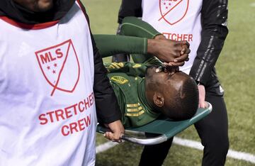 Mabiala salió del partido con gran dolor.