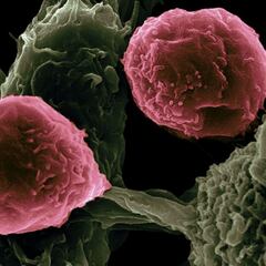 Un estudio del CSIC encuentra la forma de frenar el avance de los tumores