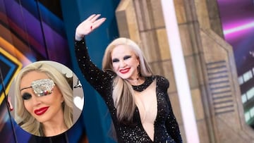 Alaska, tras perder la “visión total” de un ojo por un trombo: “La recuperación no es de un día para otro”