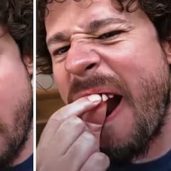 El momento en el que a Luisito Comunica se le caen dos dientes en transmisión en vivo