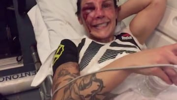 El mensaje de una desfigurada Länsberg desde la ambulancia