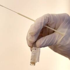 Hidroxicloroquina: qué es, para qué sirve y contraindicaciones