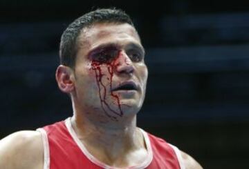 Samir El-Mais de Canadá sangra en su combate contra Warren Baister en los Juegos de la Commonwealth.