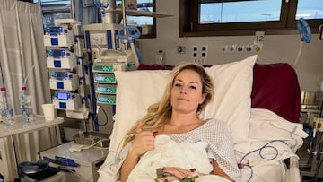 The American ski legend fractured her tibia just seconds into her downhill run at the Milan-Cortina Winter Olympics.
